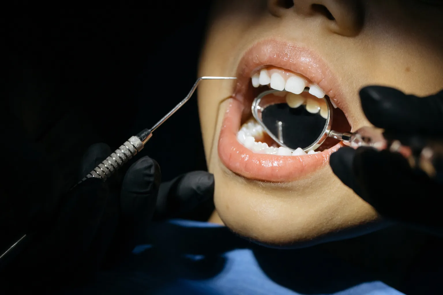 braces-creating-space-for-dental-implant-placement.
