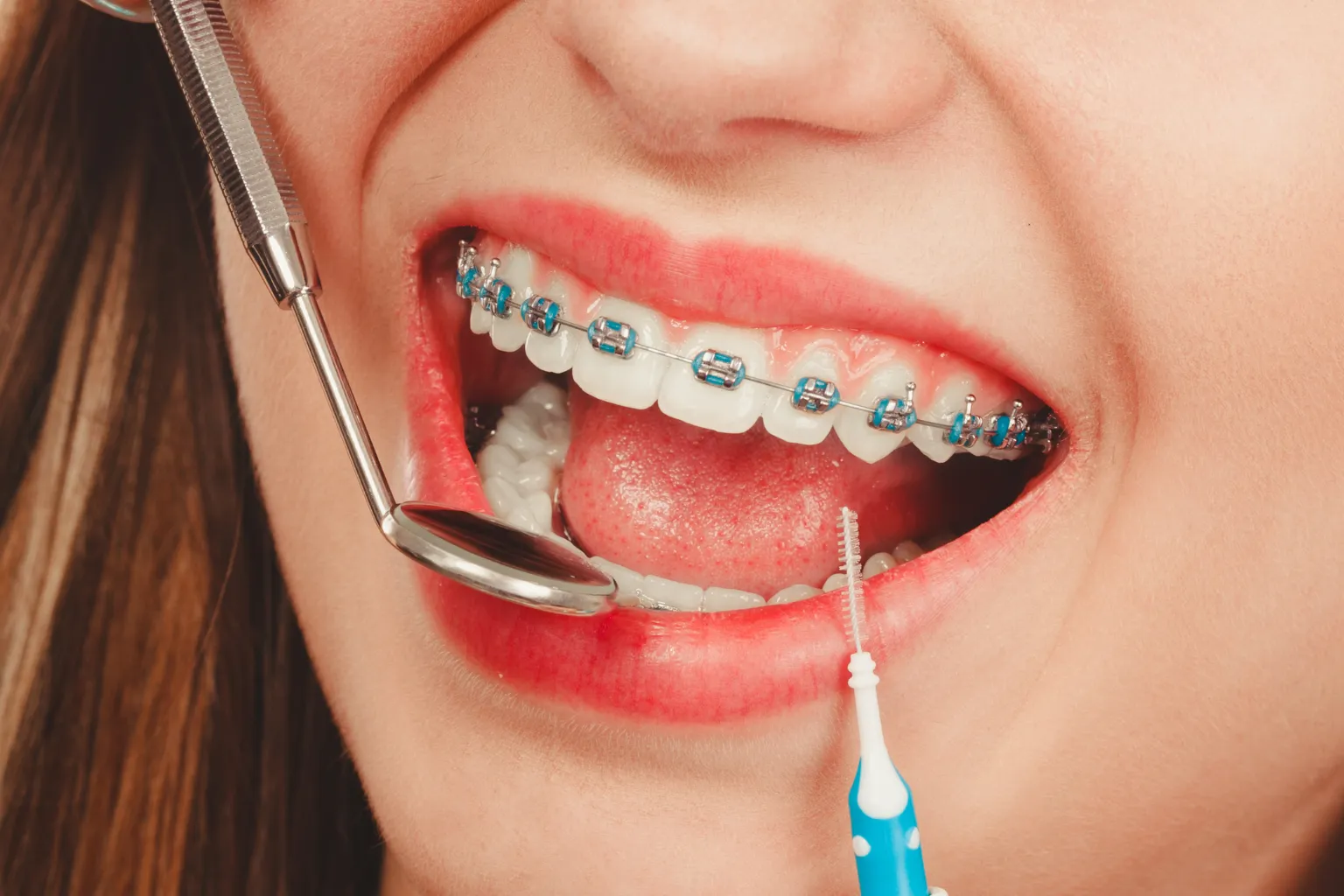 braces-friendly-school-lunch-and-cleaning-kit