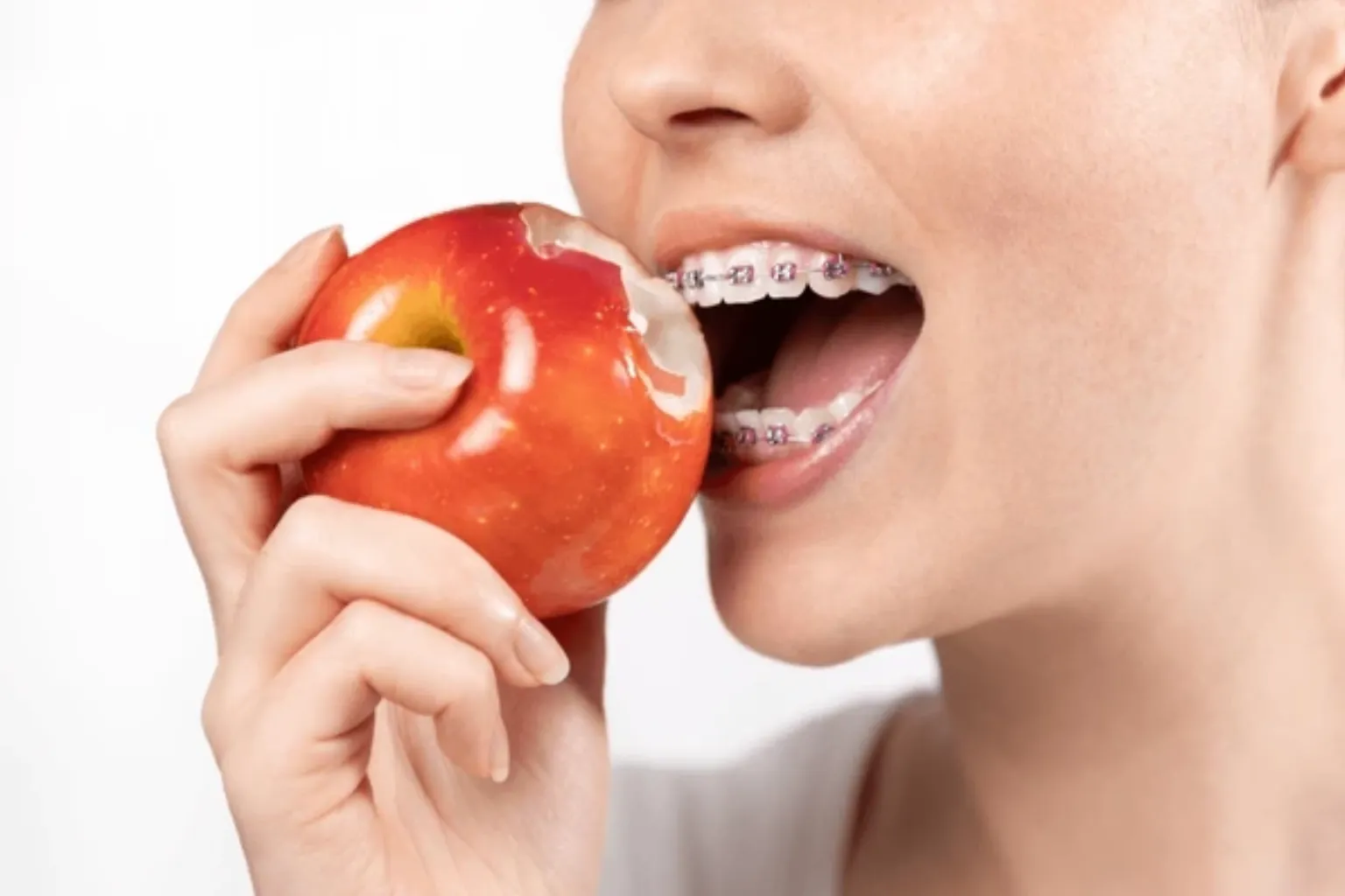 how-to-cut-apples-and-pizza-for-braces