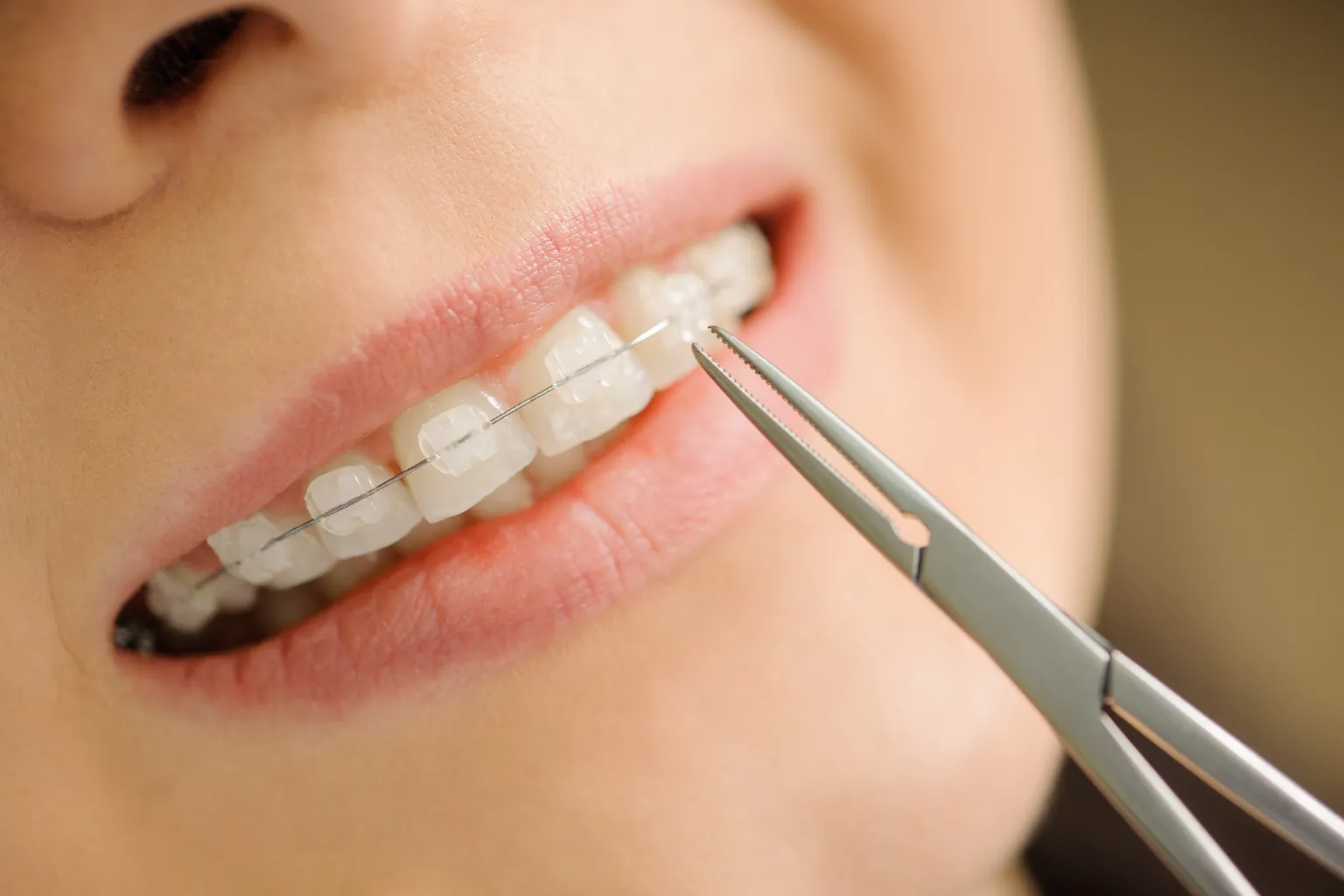 rinsing-mouth-after-coffee-with-ceramic-braces